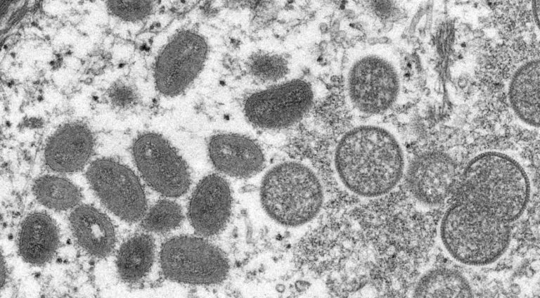 Entenda tudo sobre o surto da varíola do macaco e os riscos da doença
