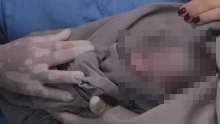 Polícia corre atrás de mãe de bebê preso à placenta